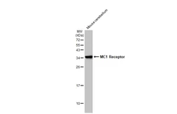 Anti-MC1 Receptor antibody [C2C3], C-term used in Western Blot (WB). GTX108190