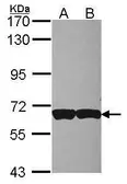 Anti-CD97 antibody [C3], C-term used in Western Blot (WB). GTX108192