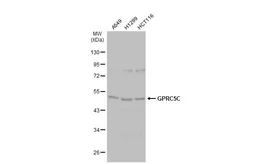 Anti-GPRC5C antibody [C3], C-term used in Western Blot (WB). GTX108193