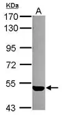 Anti-EDG3 antibody [C2C3], C-term used in Western Blot (WB). GTX108199