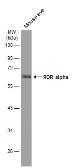 Anti-ROR alpha antibody [C3], C-term used in Western Blot (WB). GTX108201