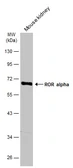 Anti-ROR alpha antibody [C3], C-term used in Western Blot (WB). GTX108201