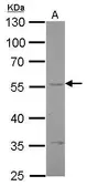 Anti-Endothelin B Receptor antibody [C3], C-term used in Western Blot (WB). GTX108204
