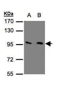 Anti-mGluR3 antibody [C3], C-term used in Western Blot (WB). GTX108212