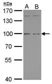Anti-GPRC6A antibody [C3], C-term used in Western Blot (WB). GTX108214