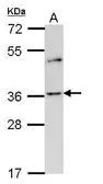 Anti-OR2A4 antibody [C2C3], C-term used in Western Blot (WB). GTX108231