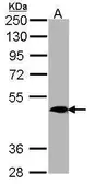 Anti-MRGPRX4 antibody [C2C3], C-term used in Western Blot (WB). GTX108233