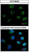 Anti-mGluR6 antibody used in Immunocytochemistry/ Immunofluorescence (ICC/IF). GTX108234