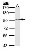 Anti-TAS1R1 antibody [C3], C-term used in Western Blot (WB). GTX108238