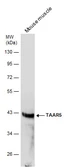 Anti-TAAR5 antibody [C2C3], C-term used in Western Blot (WB). GTX108240