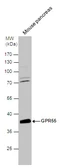 Anti-GPR55 antibody used in Western Blot (WB). GTX108243