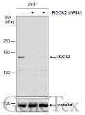 Anti-ROCK2 antibody [N3C1], Internal used in Western Blot (WB). GTX108247