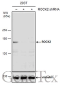 Anti-ROCK2 antibody [N3C1], Internal used in Western Blot (WB). GTX108247