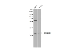 Anti-COX6B1 antibody [N2C3] used in Western Blot (WB). GTX108249