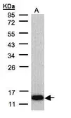 Anti-COX6A2 antibody [N3C3] used in Western Blot (WB). GTX108261