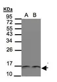 Anti-Thioredoxin antibody [N3C3] used in Western Blot (WB). GTX108263