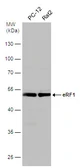 Anti-eRF1 antibody used in Western Blot (WB). GTX108271
