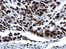 Anti-Histone H2A.X antibody used in IHC (Paraffin sections) (IHC-P). GTX108272
