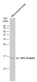 Anti-REG III alpha antibody [C1C3] used in Western Blot (WB). GTX108275