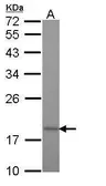 Anti-TIM17 antibody [C1C3] used in Western Blot (WB). GTX108280