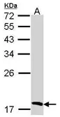 Anti-Flavin reductase antibody [C2C3], C-term used in Western Blot (WB). GTX108288