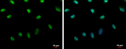 Anti-Histone H2A.X antibody [N1N2], N-term used in Immunocytochemistry/ Immunofluorescence (ICC/IF). GTX108297