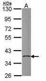 Anti-PDIK1L antibody [N1], N-term used in Western Blot (WB). GTX108313