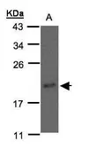 Anti-nm23-H3 antibody [C1C3] used in Western Blot (WB). GTX108324
