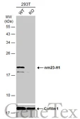 Anti-nm23-H1 antibody [C1C3] used in Western Blot (WB). GTX108325