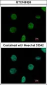 Anti-C1orf57 antibody [C2C3], C-term used in Immunocytochemistry/ Immunofluorescence (ICC/IF). GTX108326