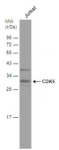 Anti-CDK5 antibody [C2C3], C-term used in Western Blot (WB). GTX108328