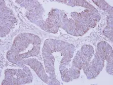 Anti-PHKA2 antibody [C3], C-term used in IHC (Paraffin sections) (IHC-P). GTX108342