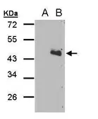 Anti-DRICH1 antibody [C2C3], C-term used in Western Blot (WB). GTX108358