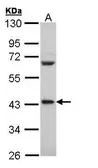 Anti-PCBP2 antibody [C2C3], C-term used in Western Blot (WB). GTX108362