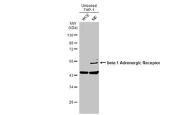 Anti-beta 1 Adrenergic Receptor antibody [C3], C-term used in Western Blot (WB). GTX108366