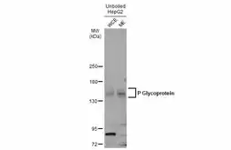 Anti-P Glycoprotein antibody used in Western Blot (WB). GTX108370