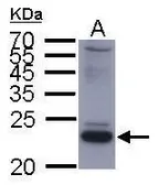 Anti-Hepatitis B virus 2a small S Protein antibody used in Western Blot (WB). GTX108380