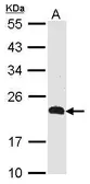 Anti-CKLFSF5 antibody [N1N2], N-term used in Western Blot (WB). GTX108383
