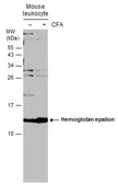 Anti-Hemoglobin epsilon antibody [N1N2], N-term used in Western Blot (WB). GTX108396