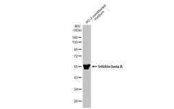 Anti-Inhibin beta A antibody used in Western Blot (WB). GTX108405