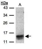 Anti-I-309 antibody used in Western Blot (WB). GTX108412