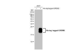 Anti-GREM2 antibody [C1C3] used in Western Blot (WB). GTX108414