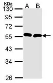 Anti-BMP9 antibody [C3], C-term used in Western Blot (WB). GTX108417