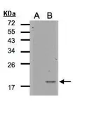 Anti-IL1F5 antibody [C1C3] used in Western Blot (WB). GTX108421