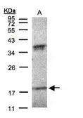 Anti-Interferon alpha 6 antibody [C1C3] used in Western Blot (WB). GTX108423