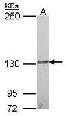 Anti-IL16 antibody [C3], C-term used in Western Blot (WB). GTX108425
