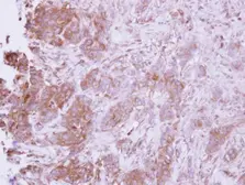 Anti-CCL14 antibody used in IHC (Paraffin sections) (IHC-P). GTX108428
