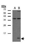 Anti-CCL14 antibody used in Western Blot (WB). GTX108428