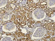 Anti-CXCL14 antibody [N3C3] used in IHC (Paraffin sections) (IHC-P). GTX108431