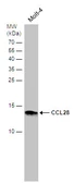Anti-CCL28 antibody [N3C3] used in Western Blot (WB). GTX108432